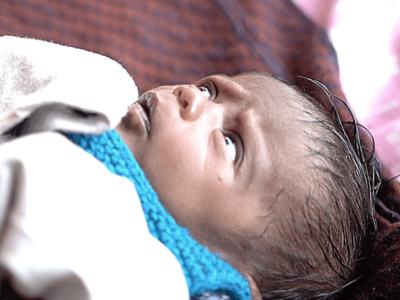 Please help newly born Baby Anvi to undergo life-saving surgery